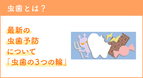 虫歯とは？最新の虫歯予防について