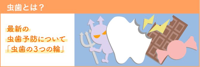 最新の虫歯予防について